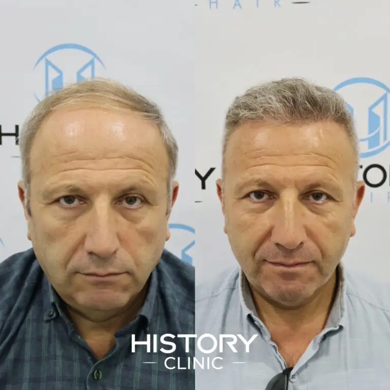 Adsız tasarım - 1